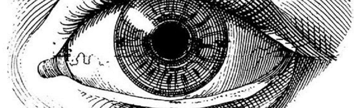 cataract surgery